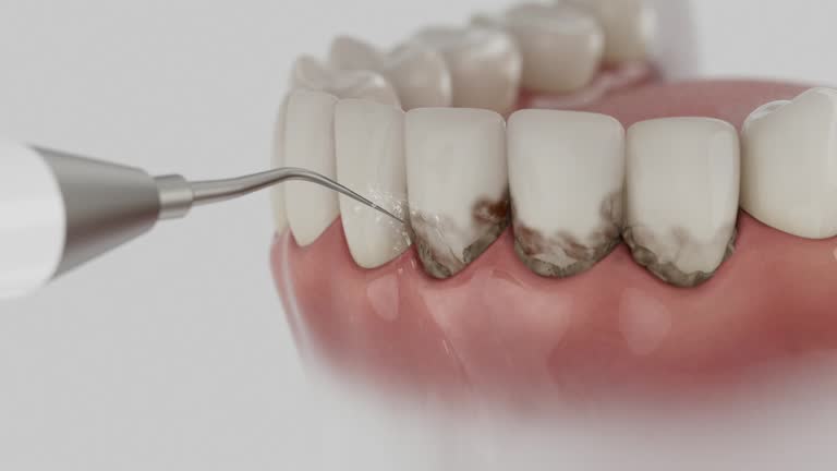 Trusted Root Canal Treatment service in Collinwood, TN - Dentist Open Now